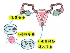 试管婴儿用供精要钱吗，伊朗试管婴儿